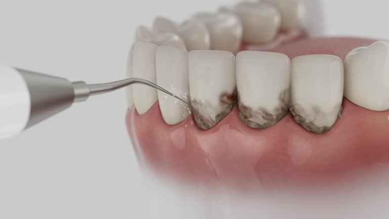 Trusted Dental Implants service in Elk Grove, CA - Dentist Open Now